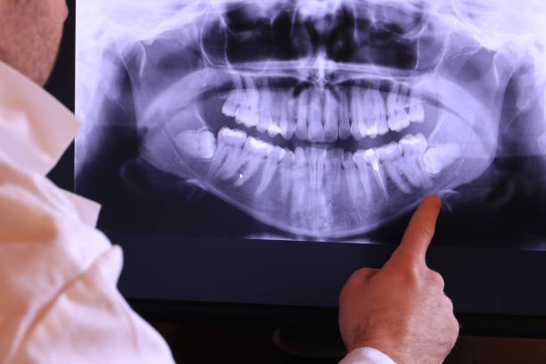 Best Same-Day Emergency Dentist in Weleetka, OK