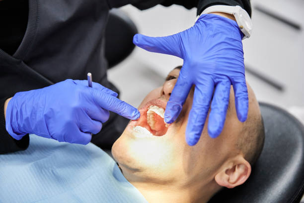 Best Emergency Wisdom Teeth Removal in Weleetka, OK