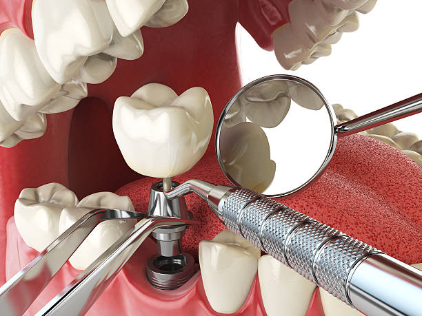 Best Emergency Dental Surgery in Weleetka, OK